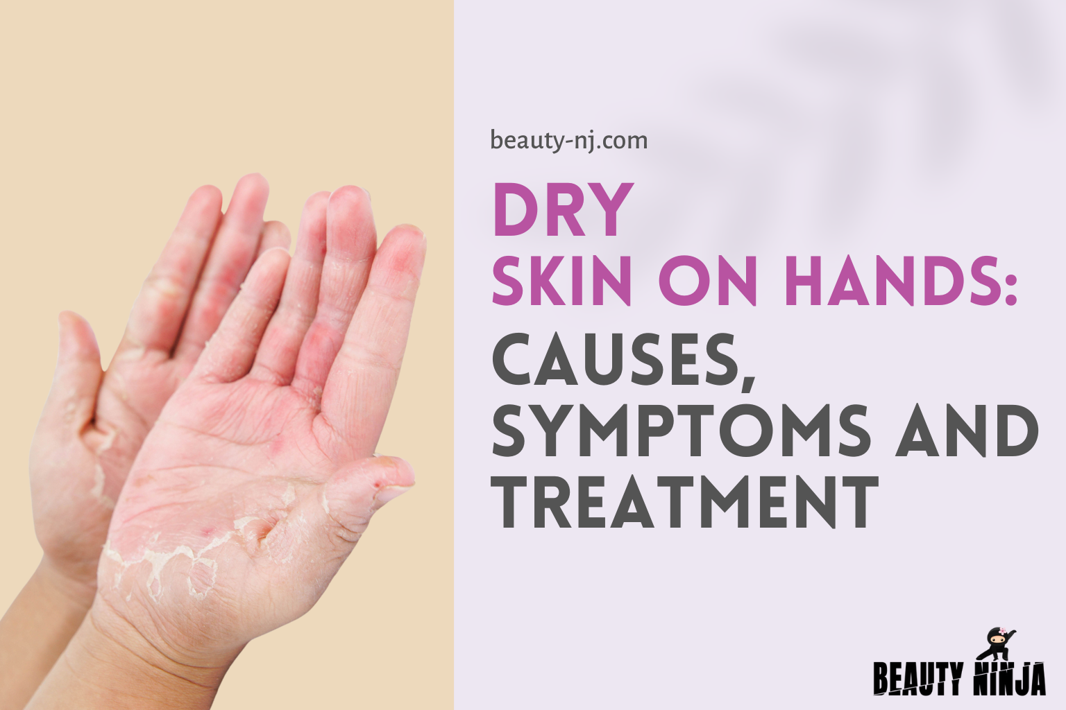 dry-skin-on-hands-causes-symptoms-and-treatment-beauty-ninja