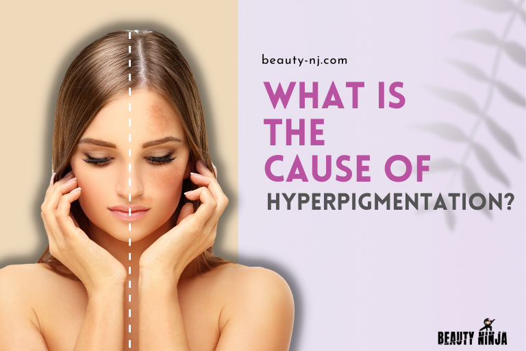 What is the Cause of Hyperpigmentation