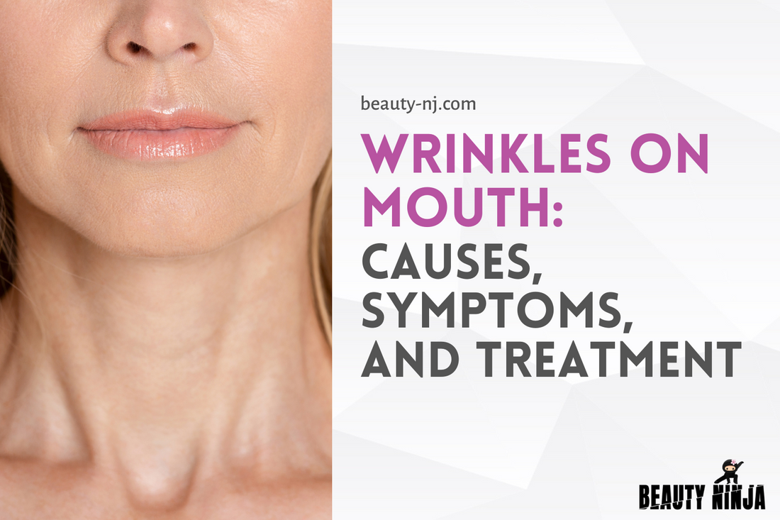 https://beauty-nj.com/cdn/shop/articles/2._wrinkles_on_mouth__causes__symptoms__and_treatment.png?v=1667759919&width=1100