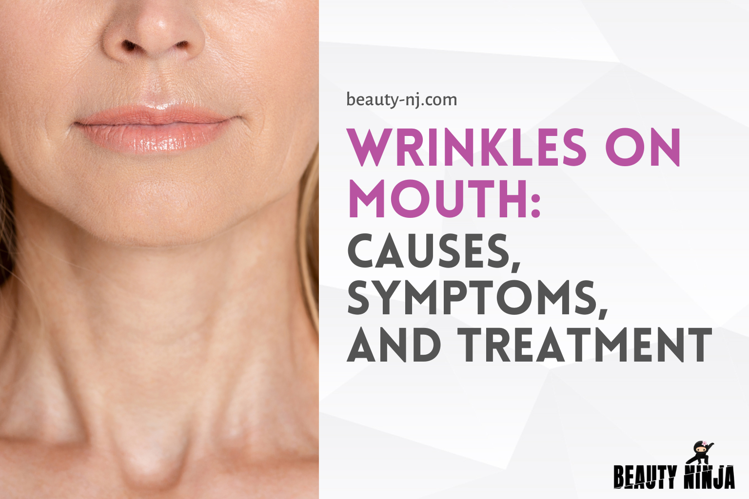 Wrinkles on Mouth: Causes, Symptoms, and Treatment