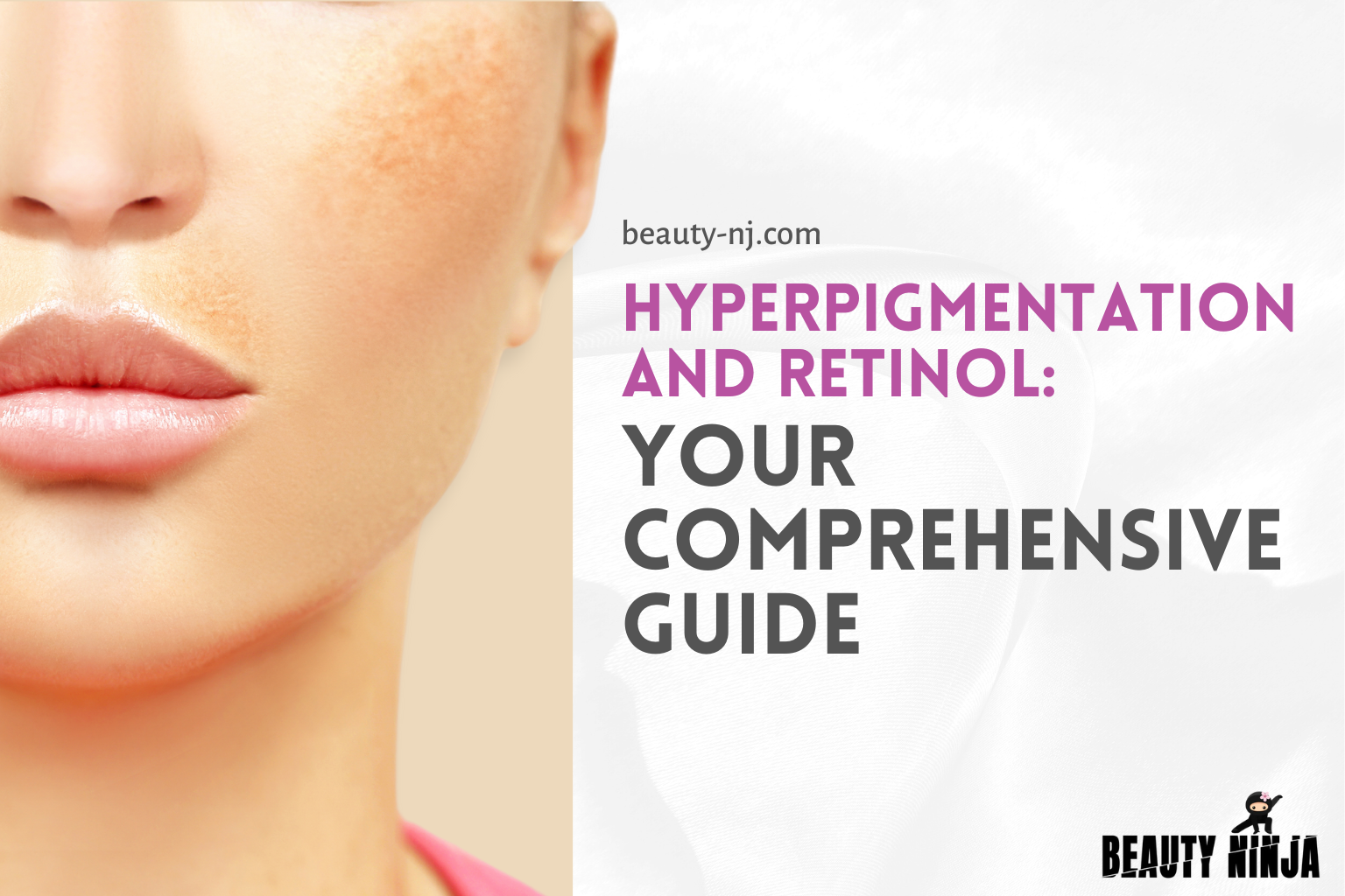 Hyperpigmentation and Retinol - Your Comprehensive Guide – Beauty Ninja