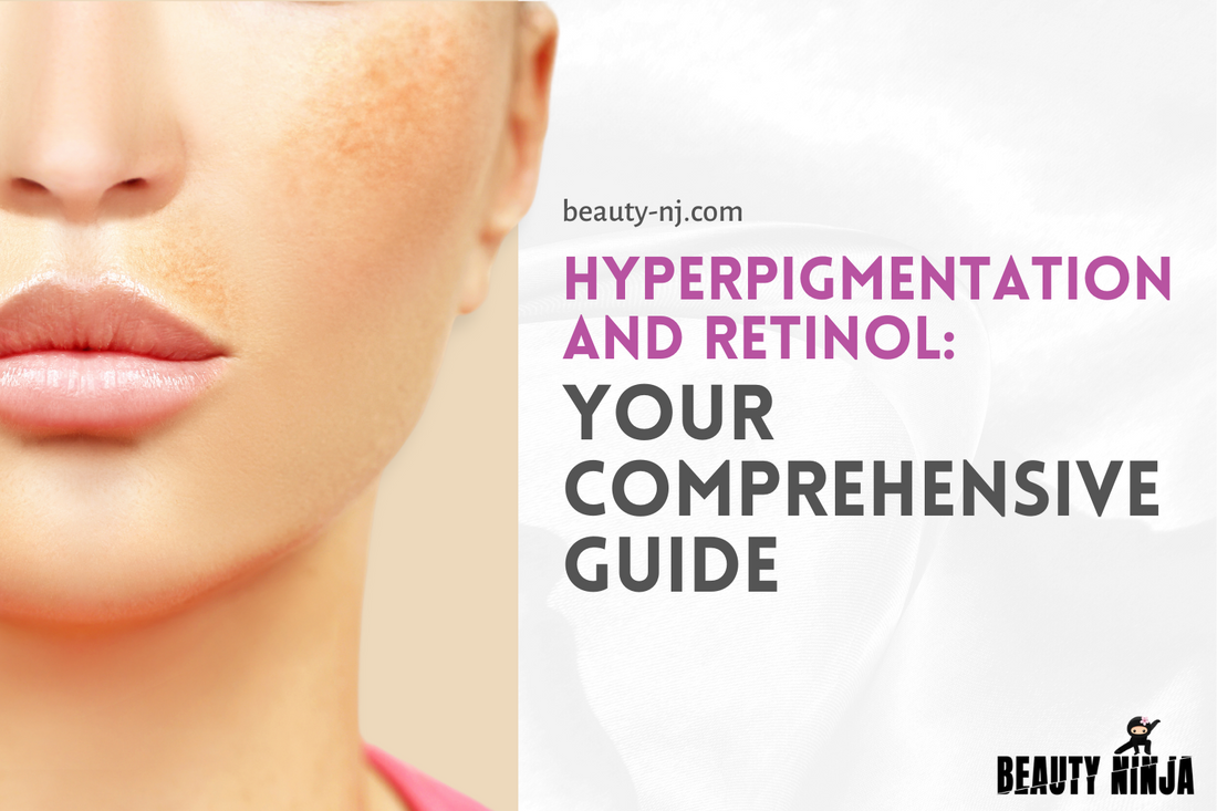 Hyperpigmentation and Retinol - Your Comprehensive Guide