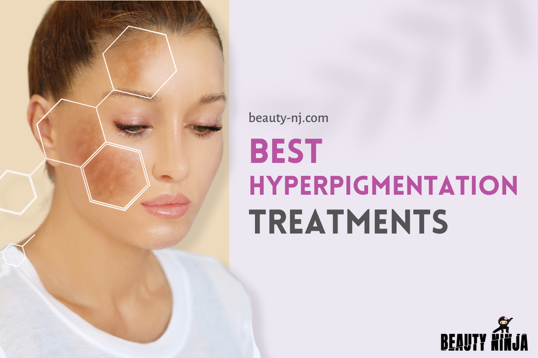 Best Hyperpigmentation Treatments