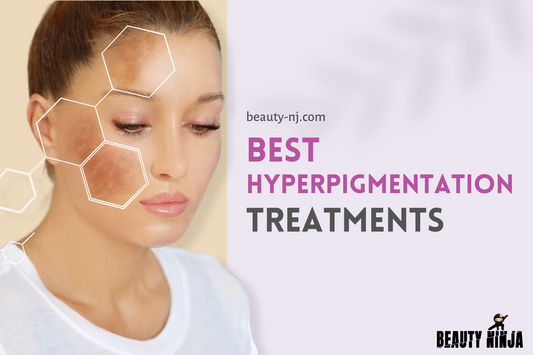 Best Hyperpigmentation Treatments
