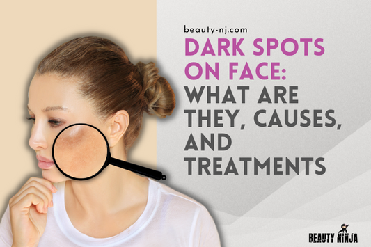 Dark Spots on Face: Causes and Treatments