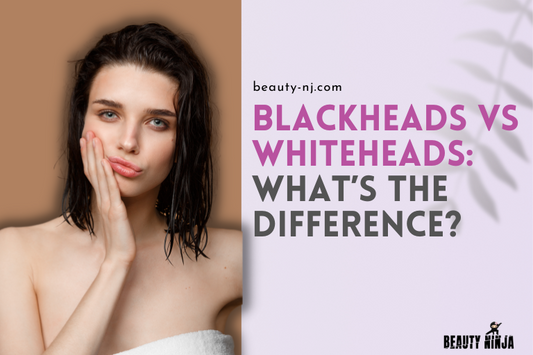 Blackheads vs Whiteheads