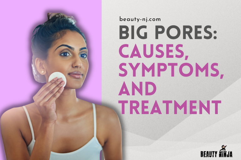 Big Pores: Causes, Symptoms, and Treatment