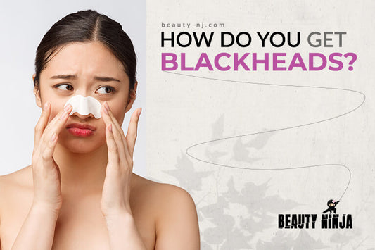 How do You Get Blackheads?