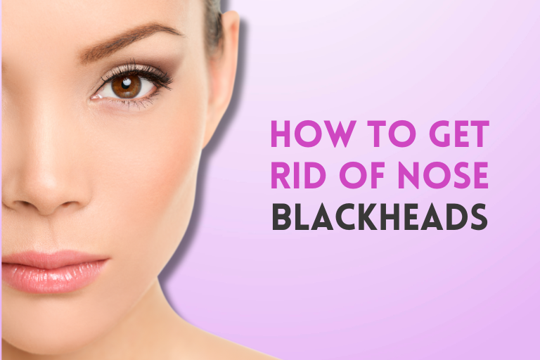 How to Get Rid of Nose Blackheads